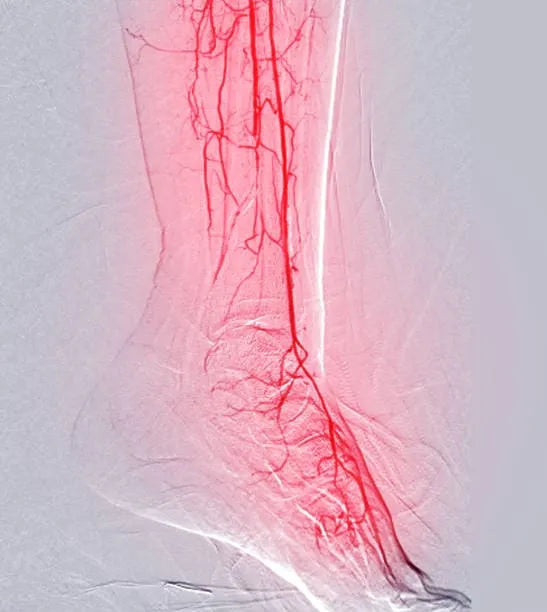 Mauvaise circulation sanguine : signes et astuces naturelles