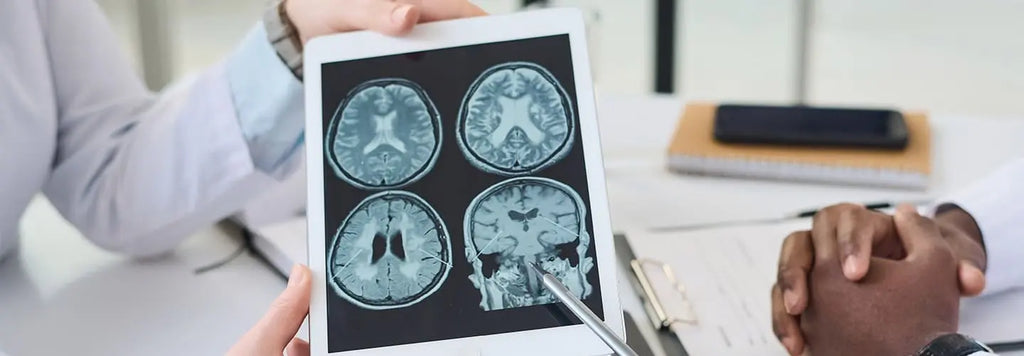 Oxygénation du cerveau : comment l'améliorer naturellement